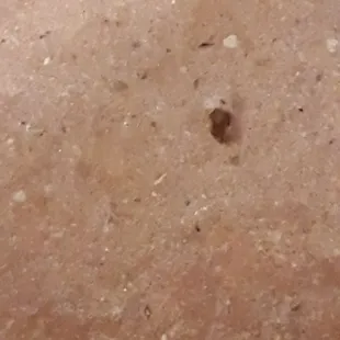 Bedbugs were all over the Master bedroom