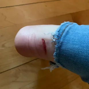 Back of daughters injured foot injured by door of restaurant walking in.   Ouch..:(