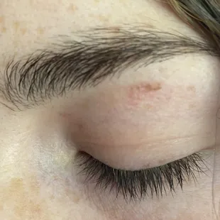 Spotlight beauty salon, burn from wax, and scab from the multiple rips