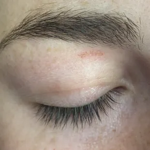 Spotlight beauty salon, burn from wax, and scab from the multiple rips