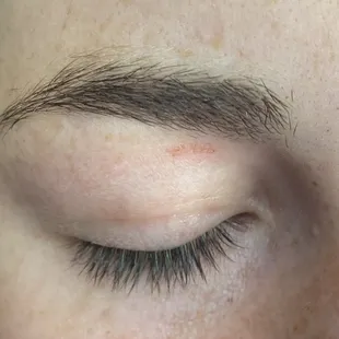 Spotlight beauty salon, scab from wax