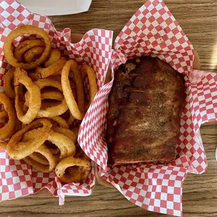 Ribs and rings