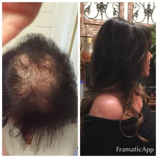 Semi permanent hair replacement by Kindra Anderson Suite 113 Studio 55