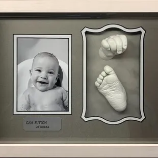 Baby Hands &amp; Feet Casting Shadow Box