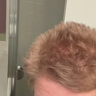 Peyton gave the worst cut I have ever had!