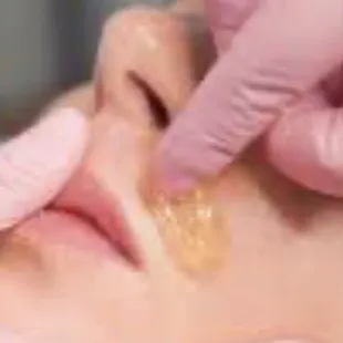Lip sugaring