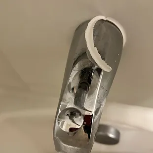 Same thing happened around the bathroom sink, which was fixed.