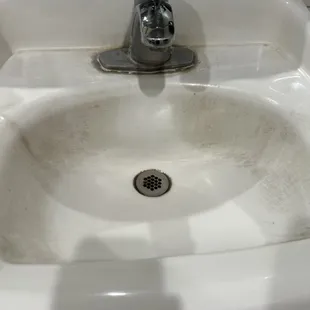 Sink is filthy to wash your hands in an eating establishment.
