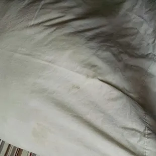 Don't know if you can see the pillow case also has stains on it.