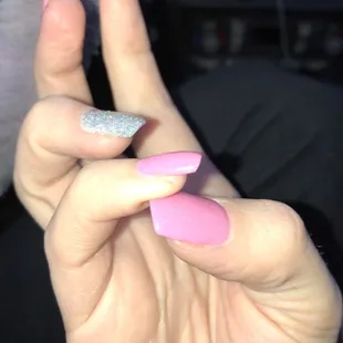 Cuts on cuticle with glue visible on glitter nail