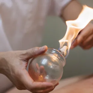 Authentic, Traditional Chinese Fire Cupping