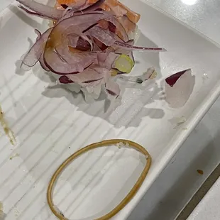 Rubber band that was in my food that I chewed on