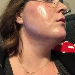 My horrible, awful reaction that STILL was charged as full price, AND received nasty comments from the owner.