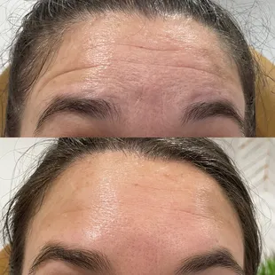 Tox Before &amp; After