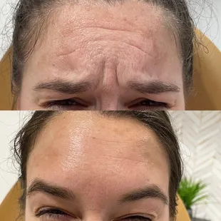 Tox Before &amp; After