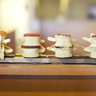 Take care of your spine and nerve system and they will take care of you.