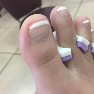 This is a picture of my big right toe