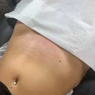Brazilian wax