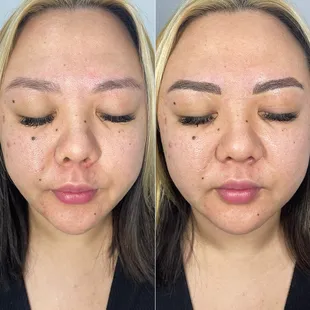 Microblading before and after