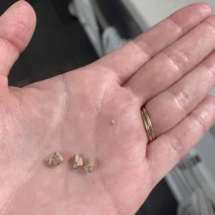 Rocks found in the bean and cheese burrito