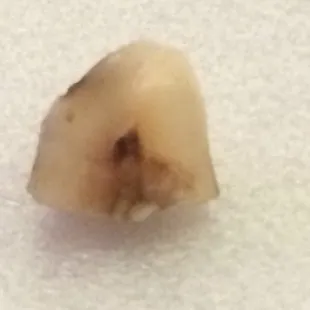 A tooth inside my taco