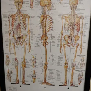 Chart for helping to show patient what is happening to cause their pain or the need for their treatment