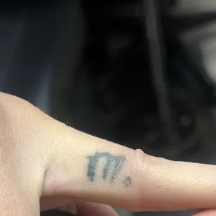 Before botched tattoo