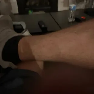 Leg