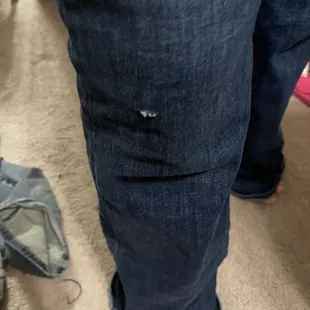 Luckily the Jeans were there to protect her leg and if it was short weather we may have had a different story