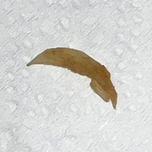 The nail in my food. Gross!!