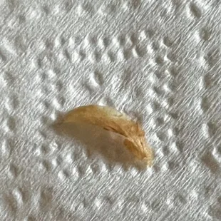 Thats a human nail!