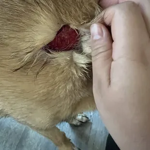 Bite