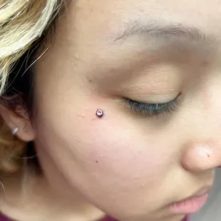 Dermal by Des