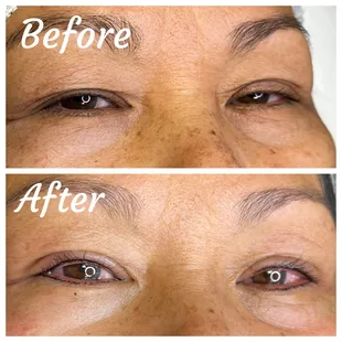 Top and bottom eyeliner