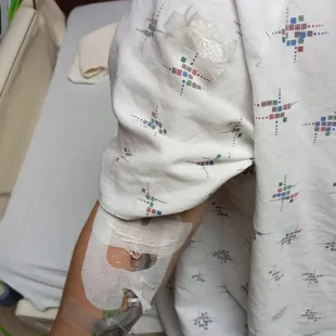 And left the trash on his arm bs