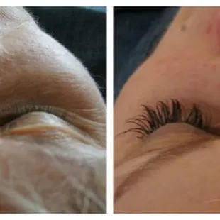 A before and after of MaryLee.