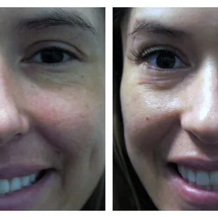 A before and after of Kristina.
