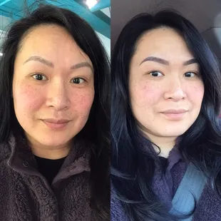 Time: 3/6/2019 Left: right before my Yearly Touch Up / no longer filling with ANY brow makeup Right: After the appt w/ Ombré