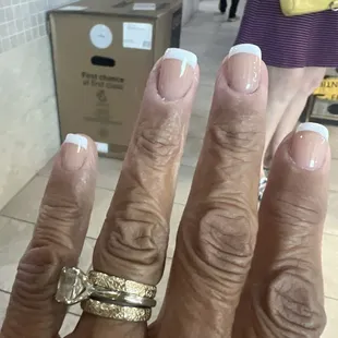 Side two of the WORST fill ever!!!!