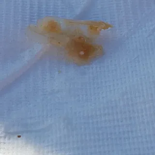 Calamari