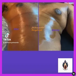 Same-day results! Reducing make boobs size. Changing bodies 1 @ a time... ⁣Thank you @fugaciousbodyandink and @getbodiedbystephanihollis