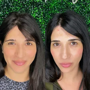 Before and after microblade eye brows