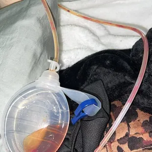 Process of explanting