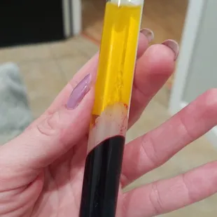 Liquid Gold is your own PRP.  There is virtually no risk of an allergic reaction or rejection.