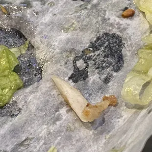 Bone shard in burger meat