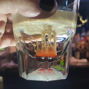 Brain hemorrhage.