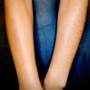 Side by Side Arm waxed vs. Arm Not Waxed