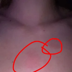 Marking on my chest from getting smacked