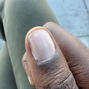 Clear gel polish cured on my skin