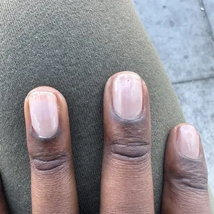Black spots on nails